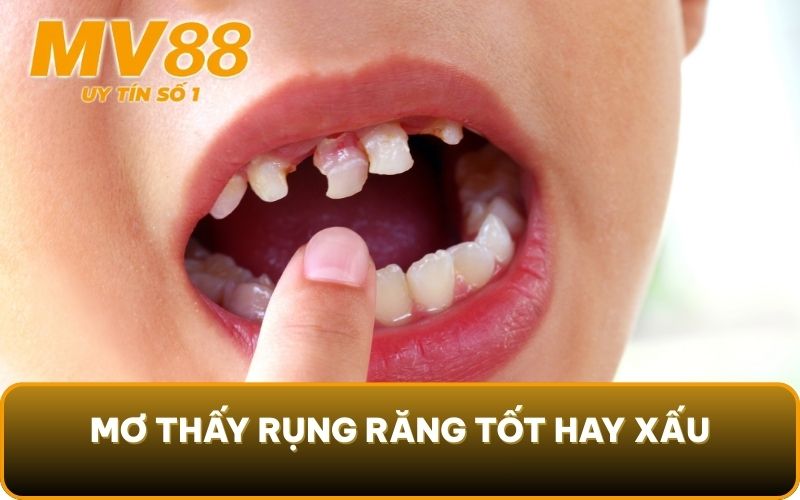 Mơ Thấy Rụng Răng - 3 Thông Điệp Tiềm Thức Muốn Gửi Đến Bạn 2 Mơ thấy rụng răng tốt hay xấu